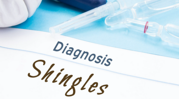 All You Need To Know About Shingles