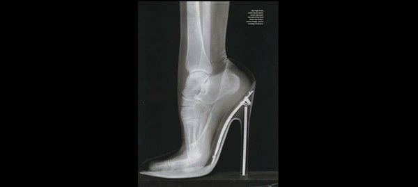 Hazards of High Heels